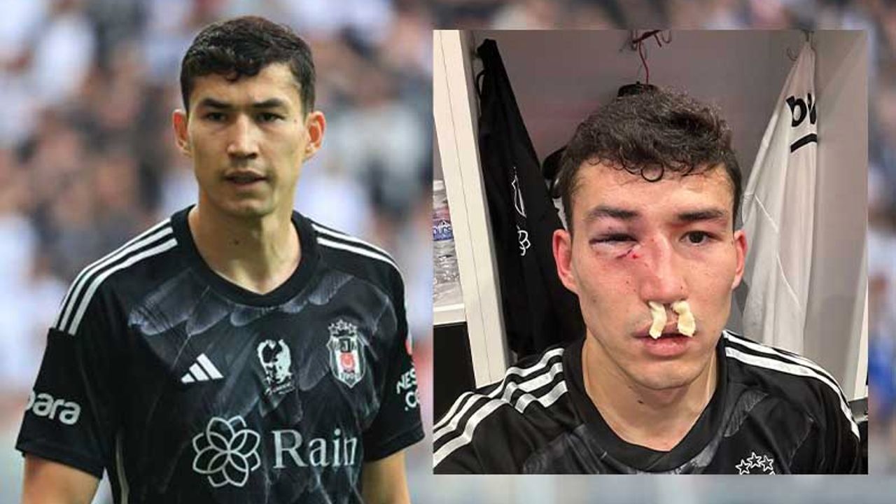 Beşiktaş'ta ağır hasar